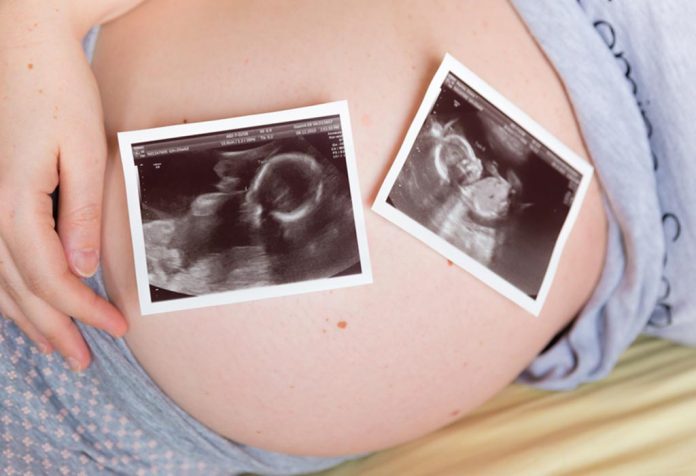 A pregnant woman with ultrasound scans on her belly