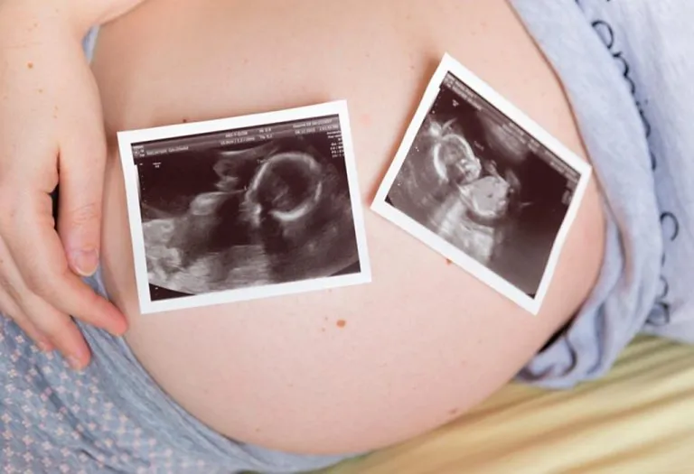 10 Creative Twin Pregnancy Announcement Ideas