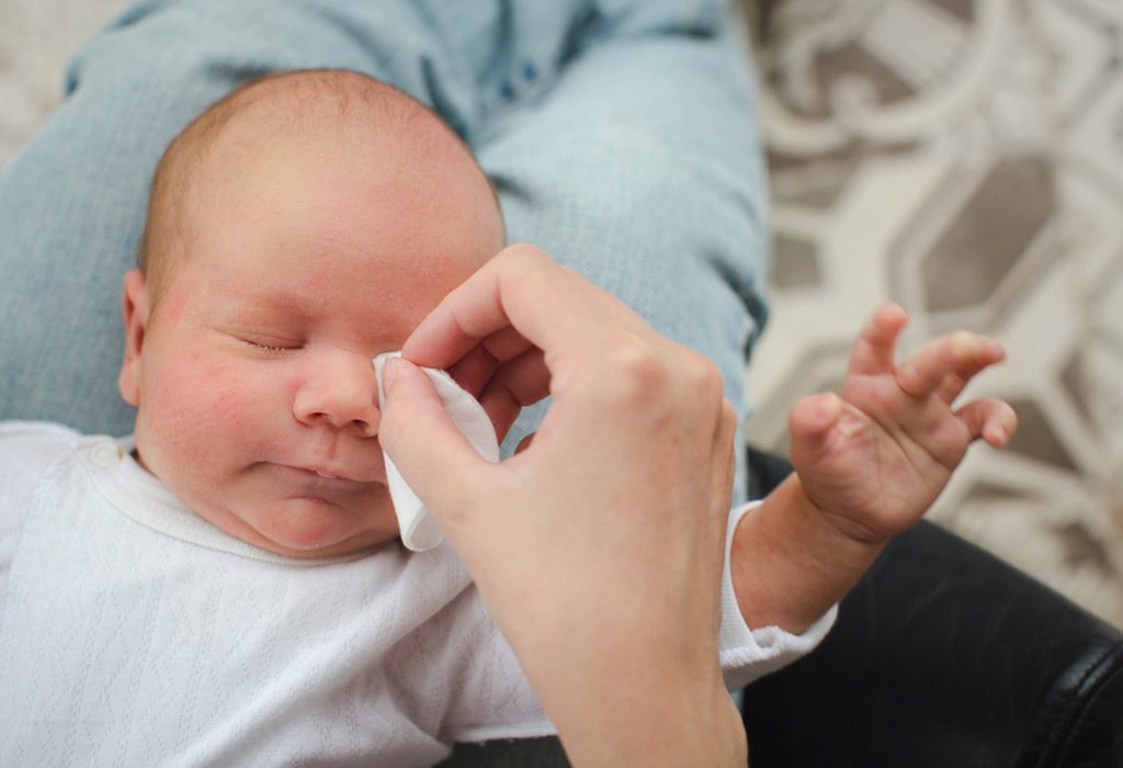 Blocked Tear Duct in Babies