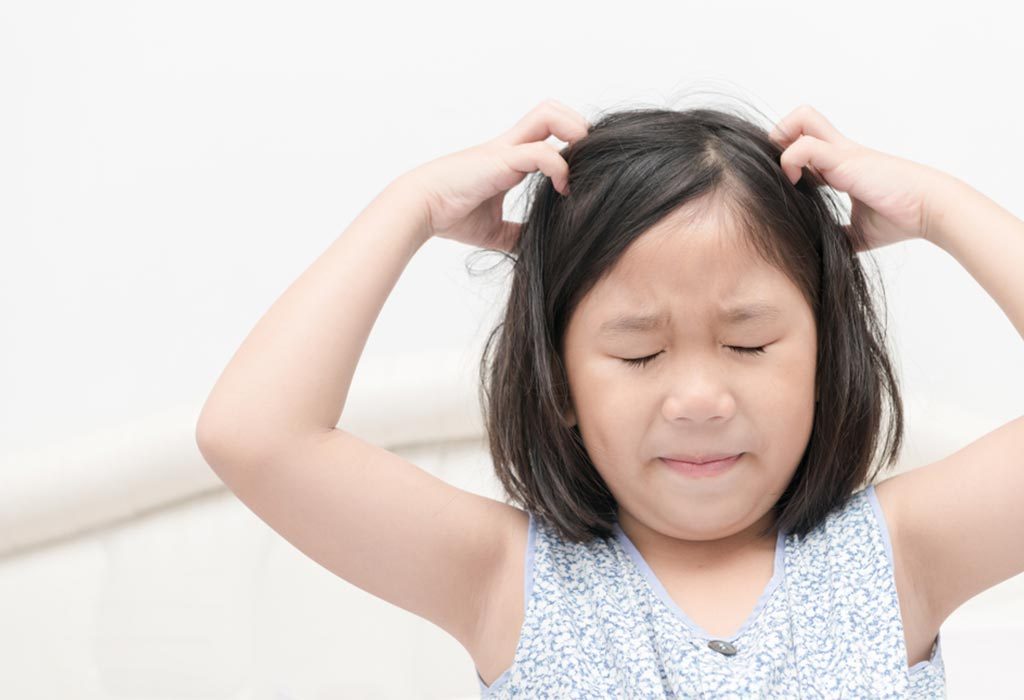 dandruff in 4 months old baby