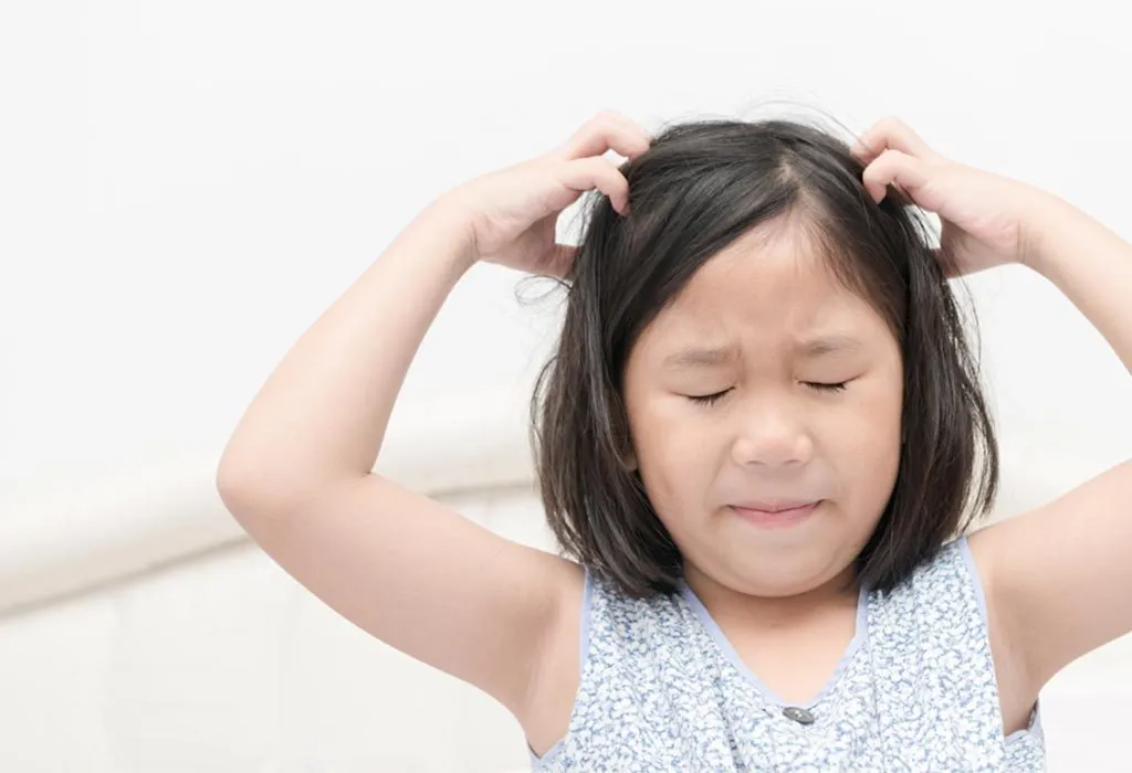 Dandruff in Kids: Causes, Treatment, and Home Remedies