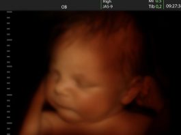 क्या बच्चे गर्भ में रोते हैं? क्या बच्चे गर्भ में रोते हैं?