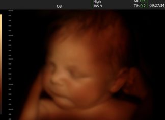 क्या बच्चे गर्भ में रोते हैं? क्या बच्चे गर्भ में रोते हैं?