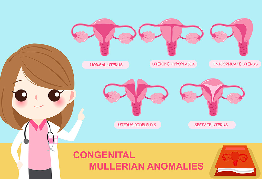 Unicornuate Uterus And Pregnancy Causes Symptoms Treatment