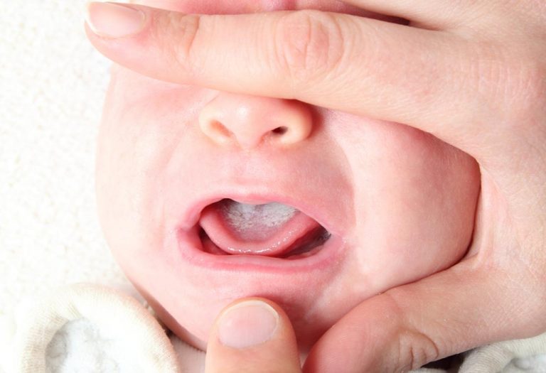 15 Most Common Infants & Newborn Problems and Diseases
