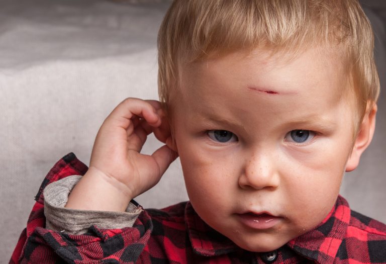 Head Injury in Children – Types, Causes & Prevention