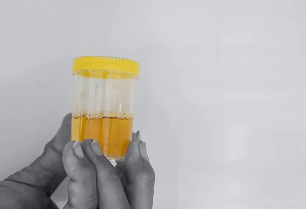 What's the Colour of urine in early pregnancy? 