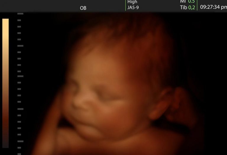 Do Babies Cry in the Womb?