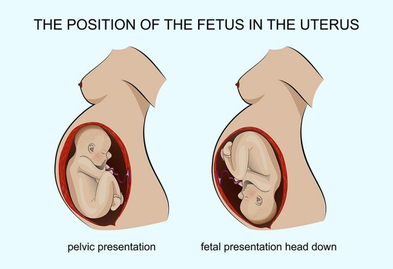 Baby's Positions in the Womb and How to Discover Them