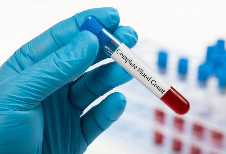 CBC (Complete Blood Count) Test in Pregnancy