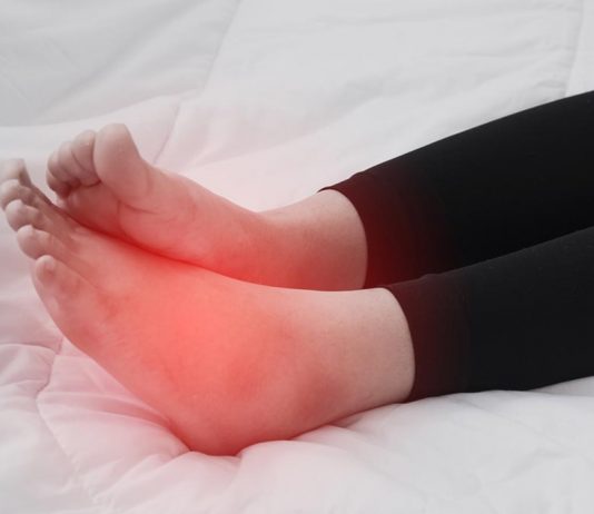 গর্ভাবস্থায় পা ফুলে যাওয়ার 12টি কার্যকর ঘরোয়া প্রতিকার