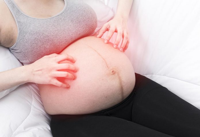 Itching during Pregnancy