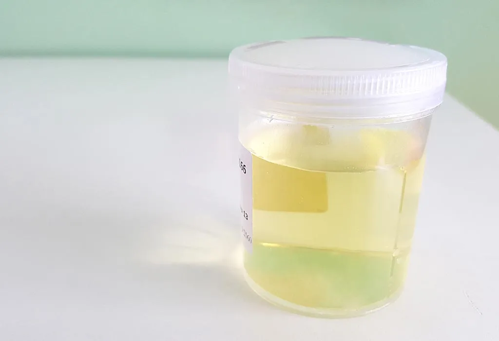 Urine sample