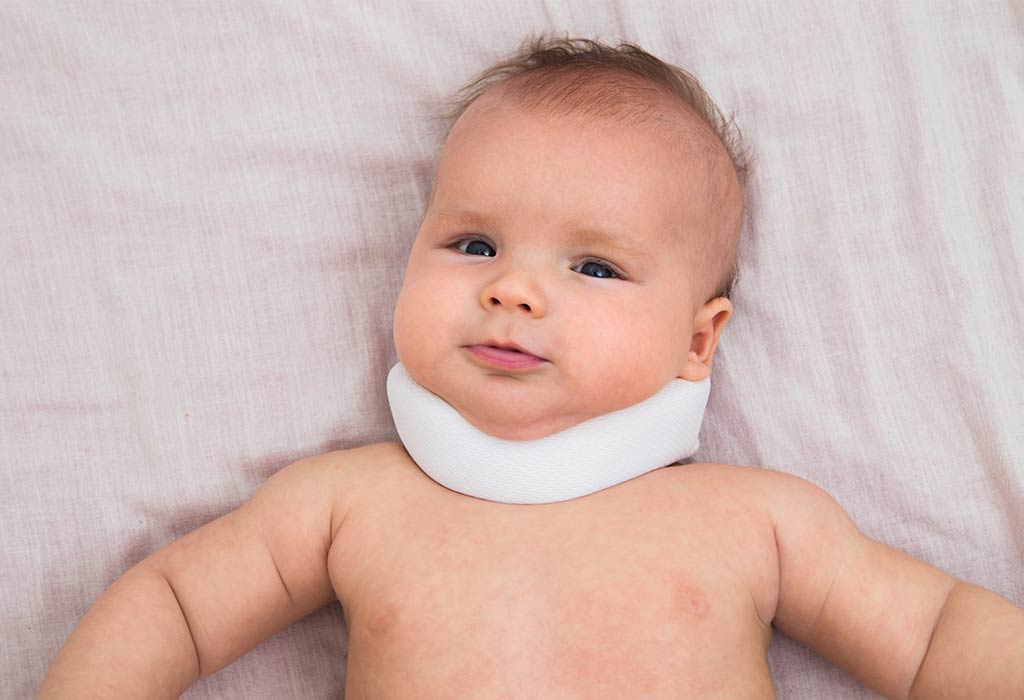 Torticollis