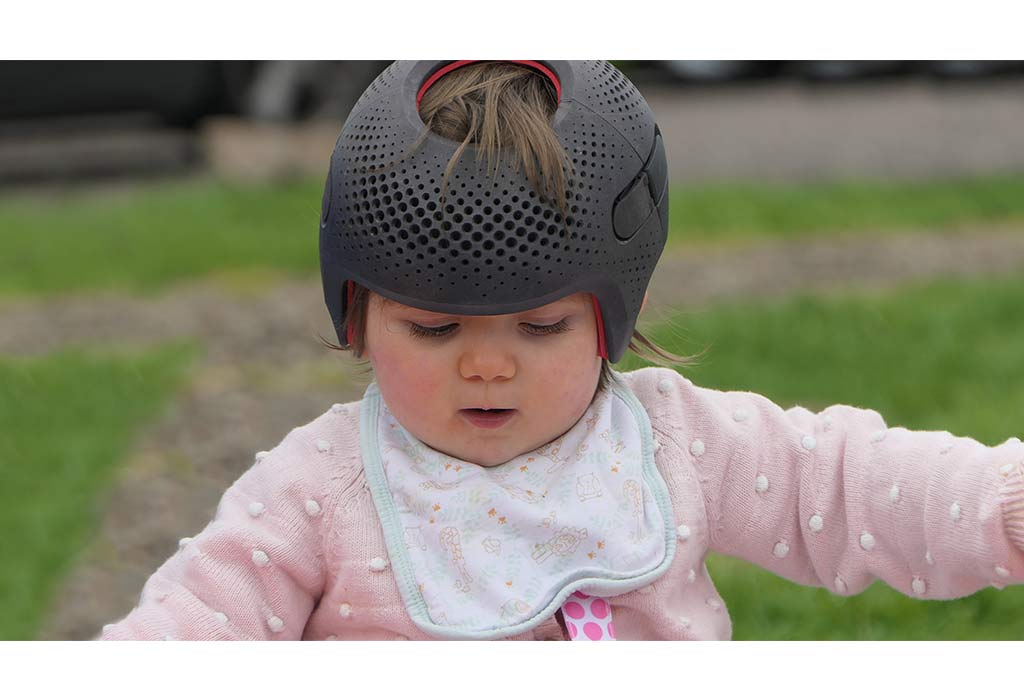Flatheads in baby treatment