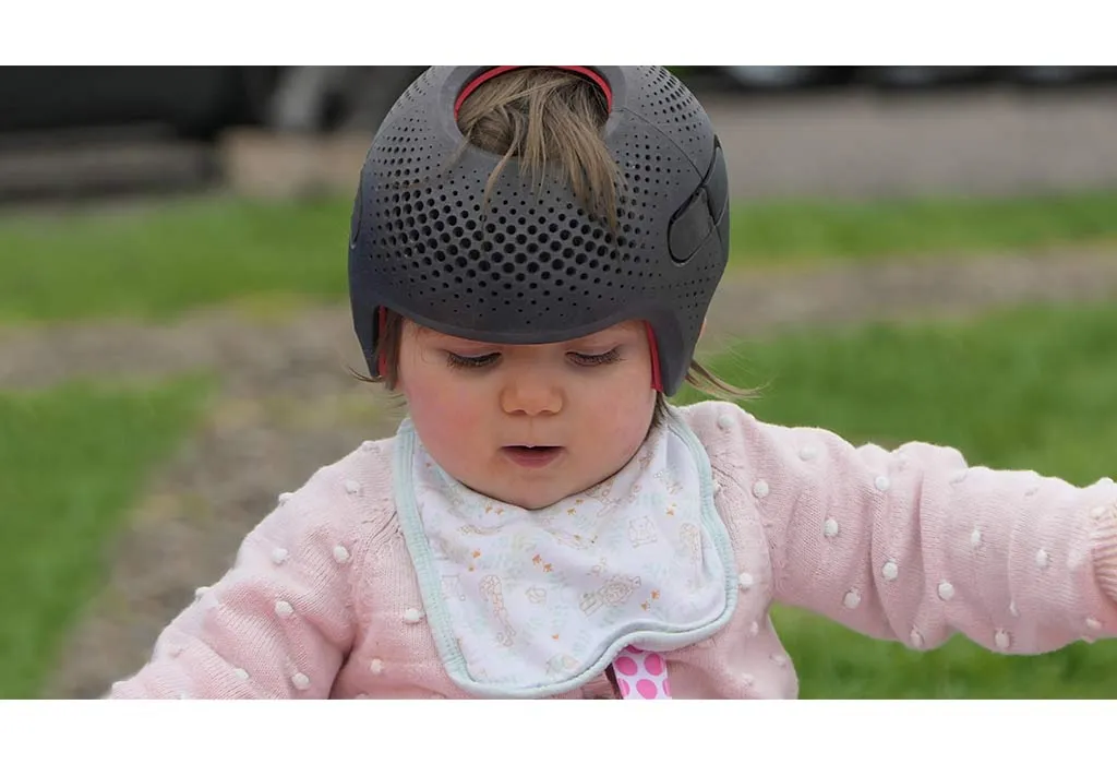 Flatheads in baby treatment Flatheads in baby treatment