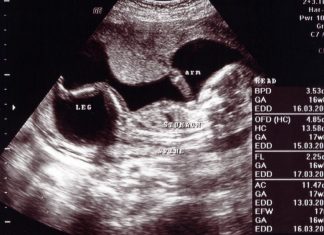 गर्भावस्था के 16वें सप्ताह में अल्ट्रासाउंड गर्भावस्था के 16वें सप्ताह में अल्ट्रासाउंड
