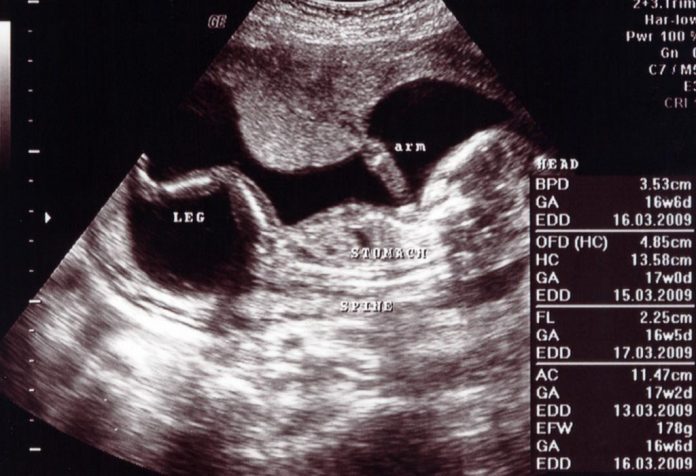गर्भावस्था के 16वें सप्ताह में अल्ट्रासाउंड