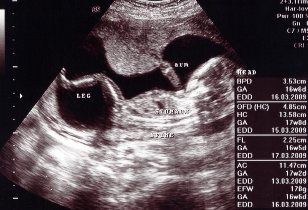 16 Weeks Pregnant Ultrasound Procedure Abnormalities And More