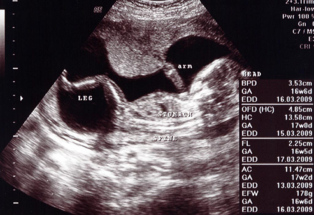 16 week sonogram