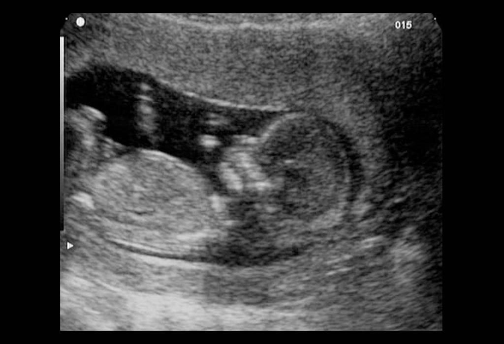 21 weeks pregnant ultrasound face