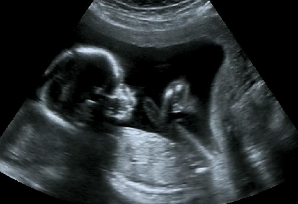 19-Week Pregnancy Ultrasound