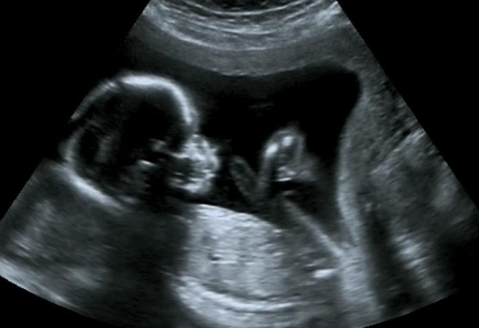 مراحل تكوين الجنين بالصور من أول يوم - شكل الجنين في الشهر الخامس