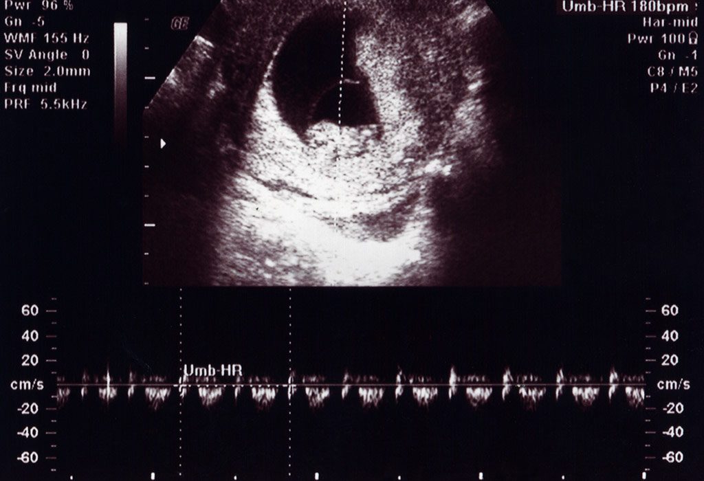 10 Weeks Pregnant Ultrasound Scan