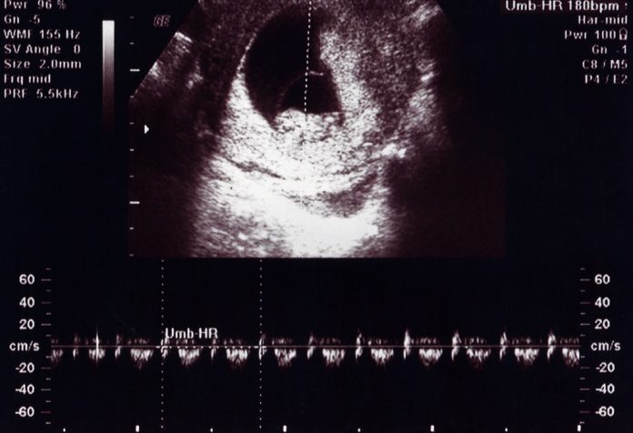गर्भावस्था के 10वें सप्ताह में अल्ट्रासाउंड