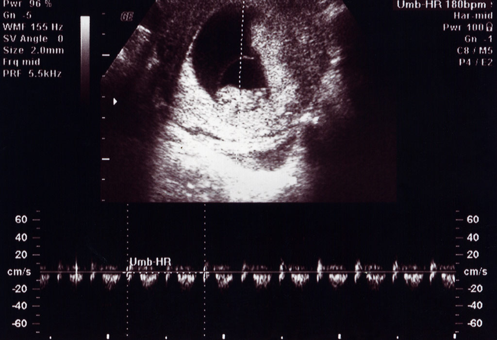 Week ultrasound 8 normal 8 week