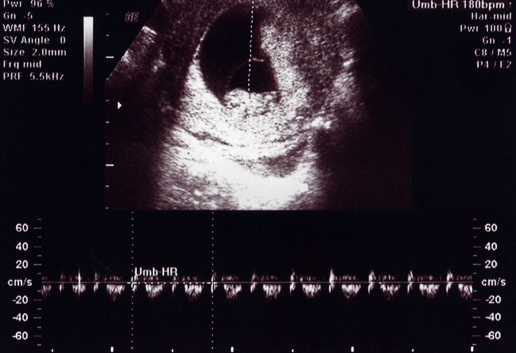 10 Week Baby Development Ultrasound