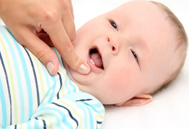 Late Teething in Babies - Causes and Complications