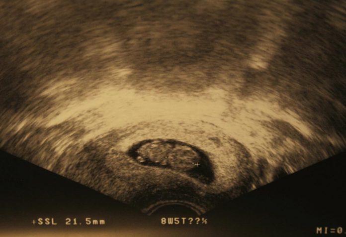 गर्भावस्था के 8वें सप्ताह में अल्ट्रासाउंड