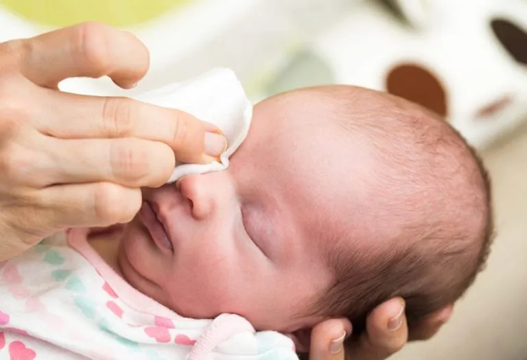 Sticky Eyes in Newborn Babies - Causes, Signs and Treatment