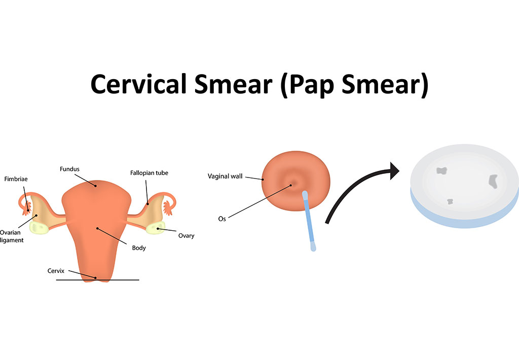 Pap Smear Test during Pregnancy Need, Safety & Risks Associated
