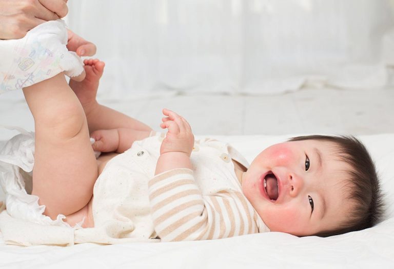 Yeast Infection Diaper Rash in Babies