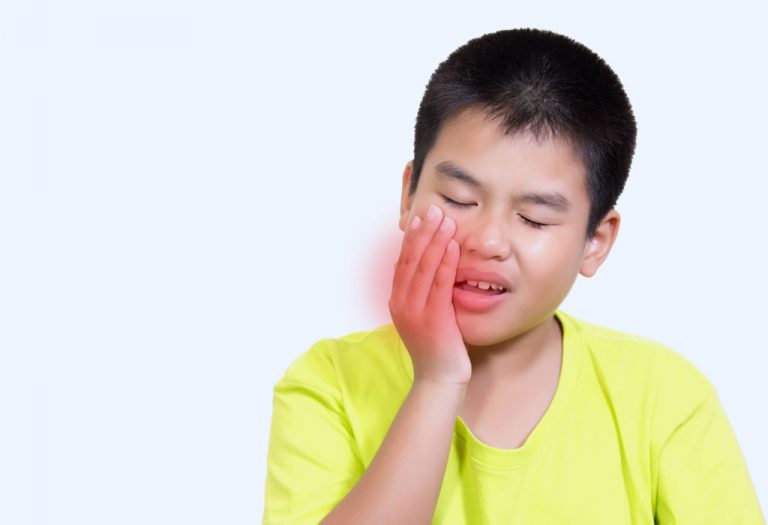 Herpetic Gingivostomatitis in Children