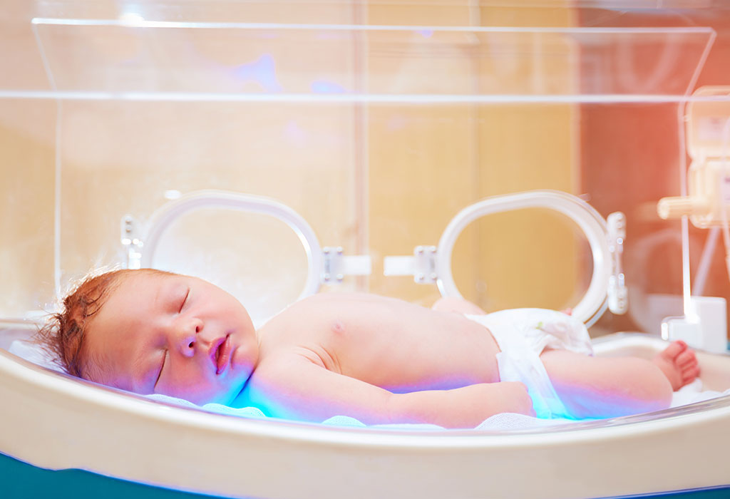 un nou-născut primește tratamentul de terapie cu lumină