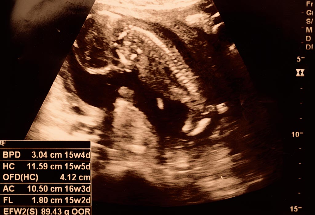 15 Weeks Pregnant Ultrasound Procedure Abnormalities And More