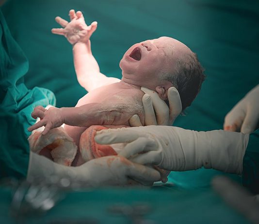 6 টি বিভিন্ন ধরণের প্রসব পদ্ধতি যেগুলি আপনার অবশ্যই জানা উচিত