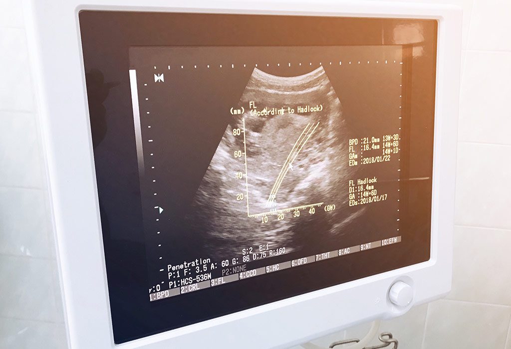 14 Weeks Pregnant Ultrasound