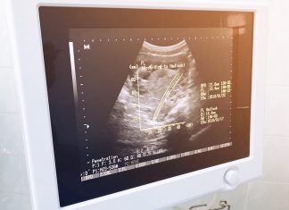 गर्भावस्था के 14वें सप्ताह में अल्ट्रासाउंड