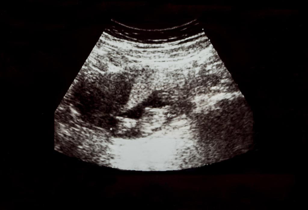 9 Weeks Pregnant Ultrasound Scan