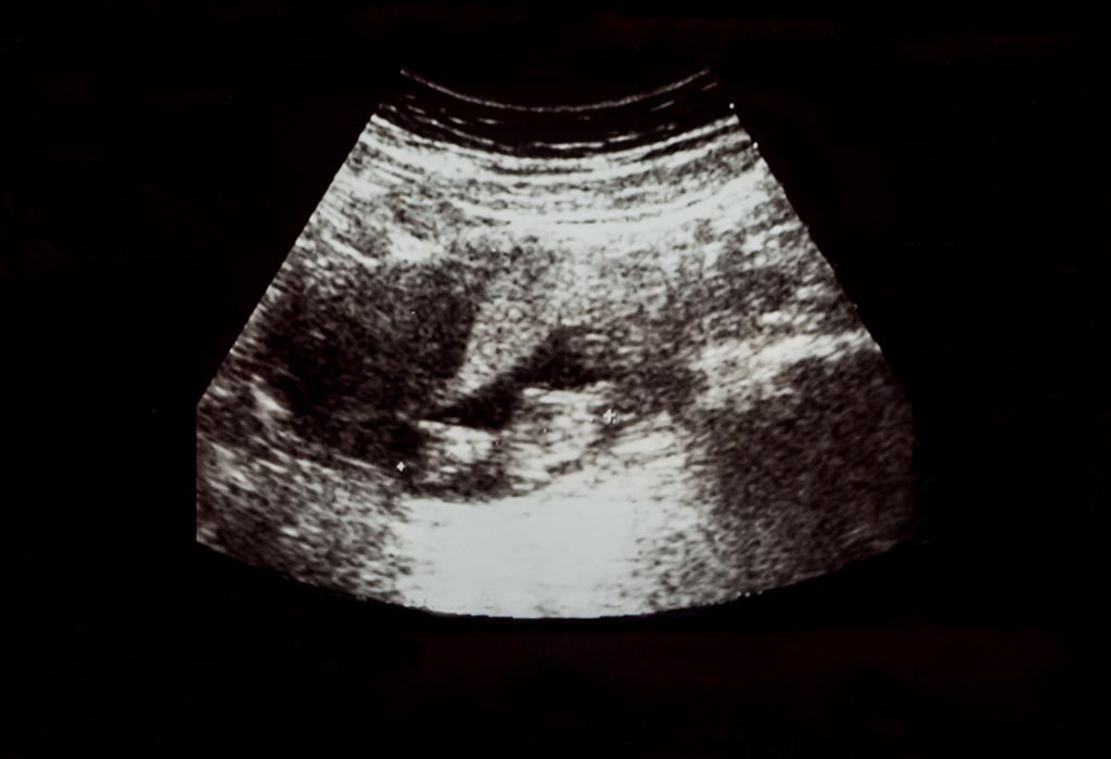 9 Weeks Pregnant Ultrasound Scan 