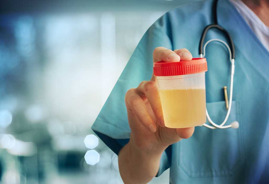 What Can the Result of a Urine Test Reveal