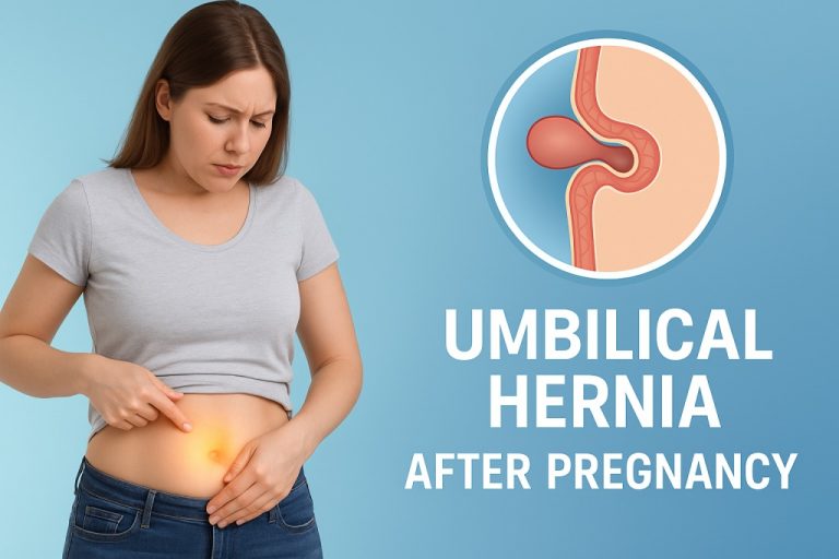 Umbilical Hernia After Pregnancy - Causes, Symptoms, and Treatment