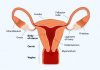 Endometrial Thickness