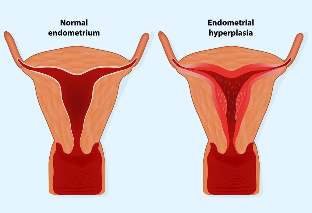 Endometrial Thickness What s The Normal Range For Conceiving 