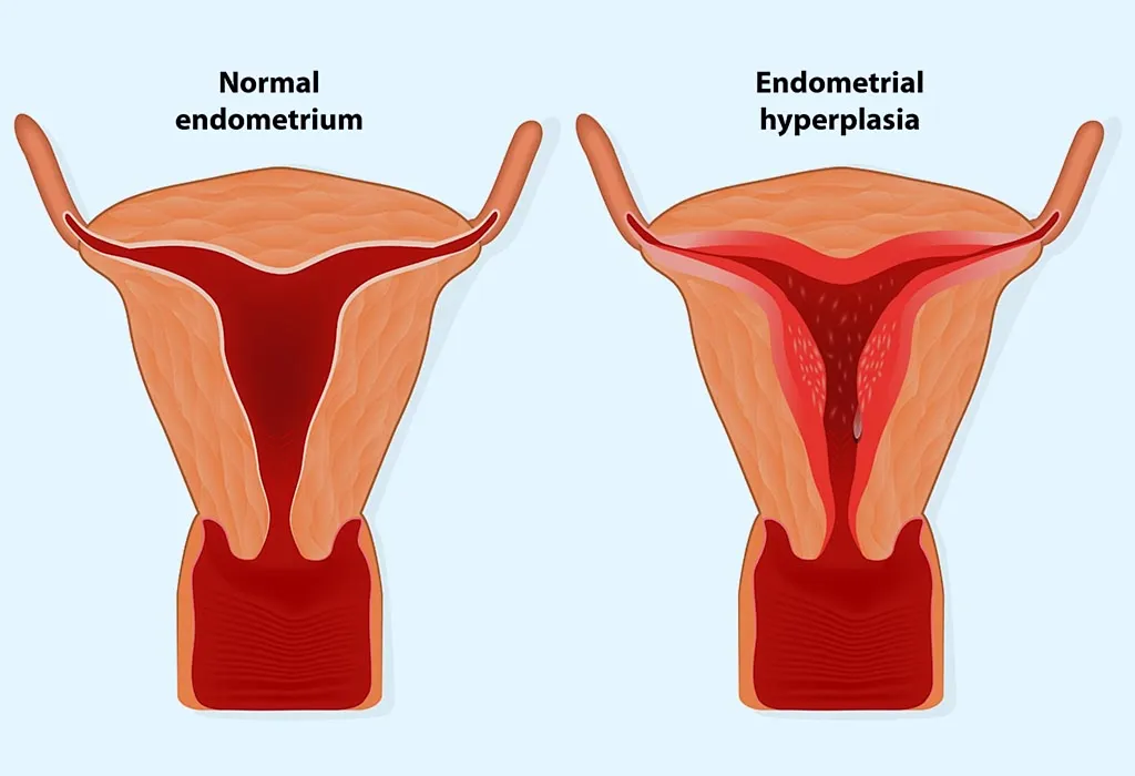 Endometrial Thickness What S The Normal Range For Conceiving