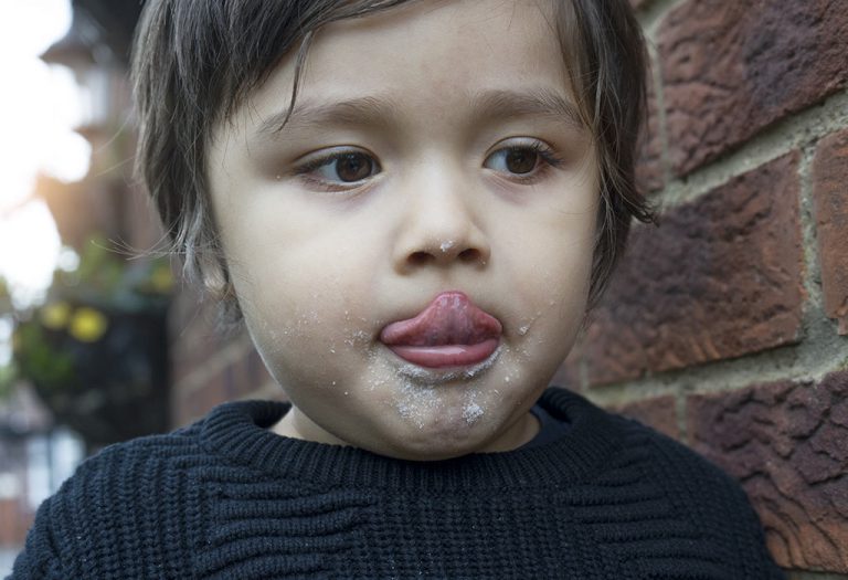Do Babies Get Chapped Lips Due to Breastfeeding?